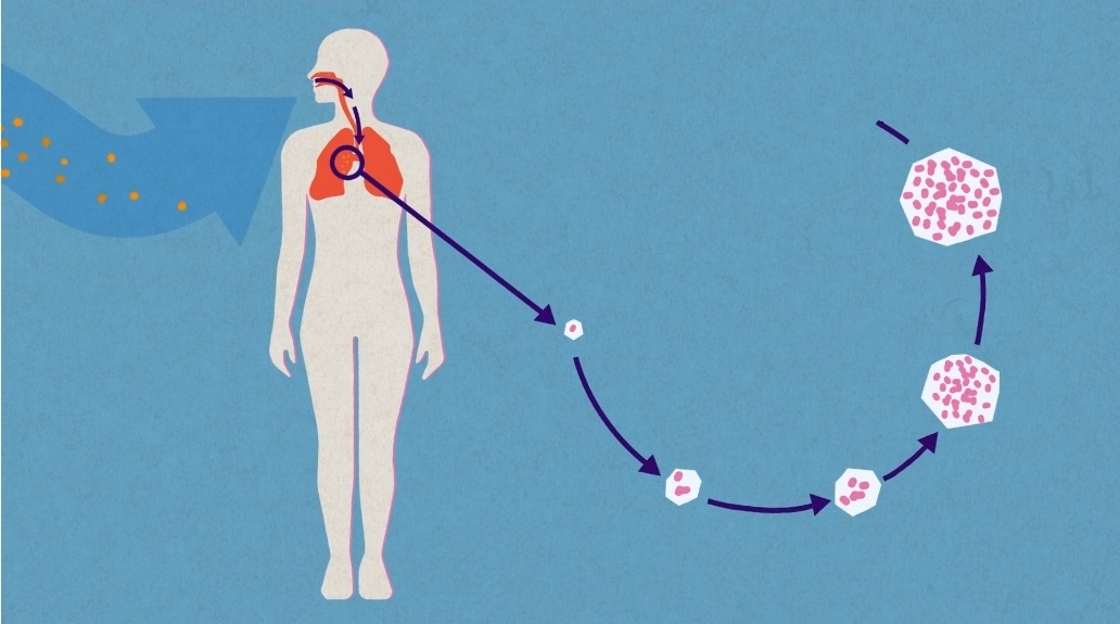 Dünyayı Tehdit Eden Yeni Süper Mikrop: Coccidioides Mantarına Dikkat!