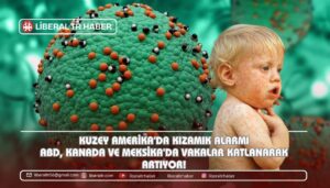 Kızamık Alarmı: ABD, Kanada ve Meksika’da Vakalar Katlanarak Artıyor!