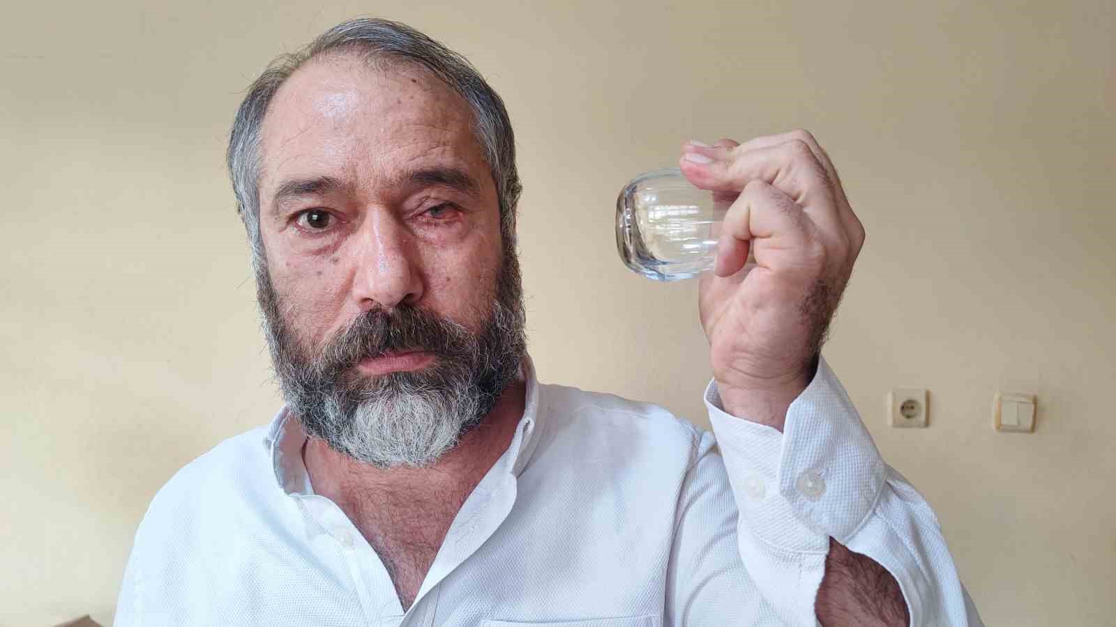 ‘Küfürlü Konuşmayın’ Diye Uyardı, Gözünden Oldu