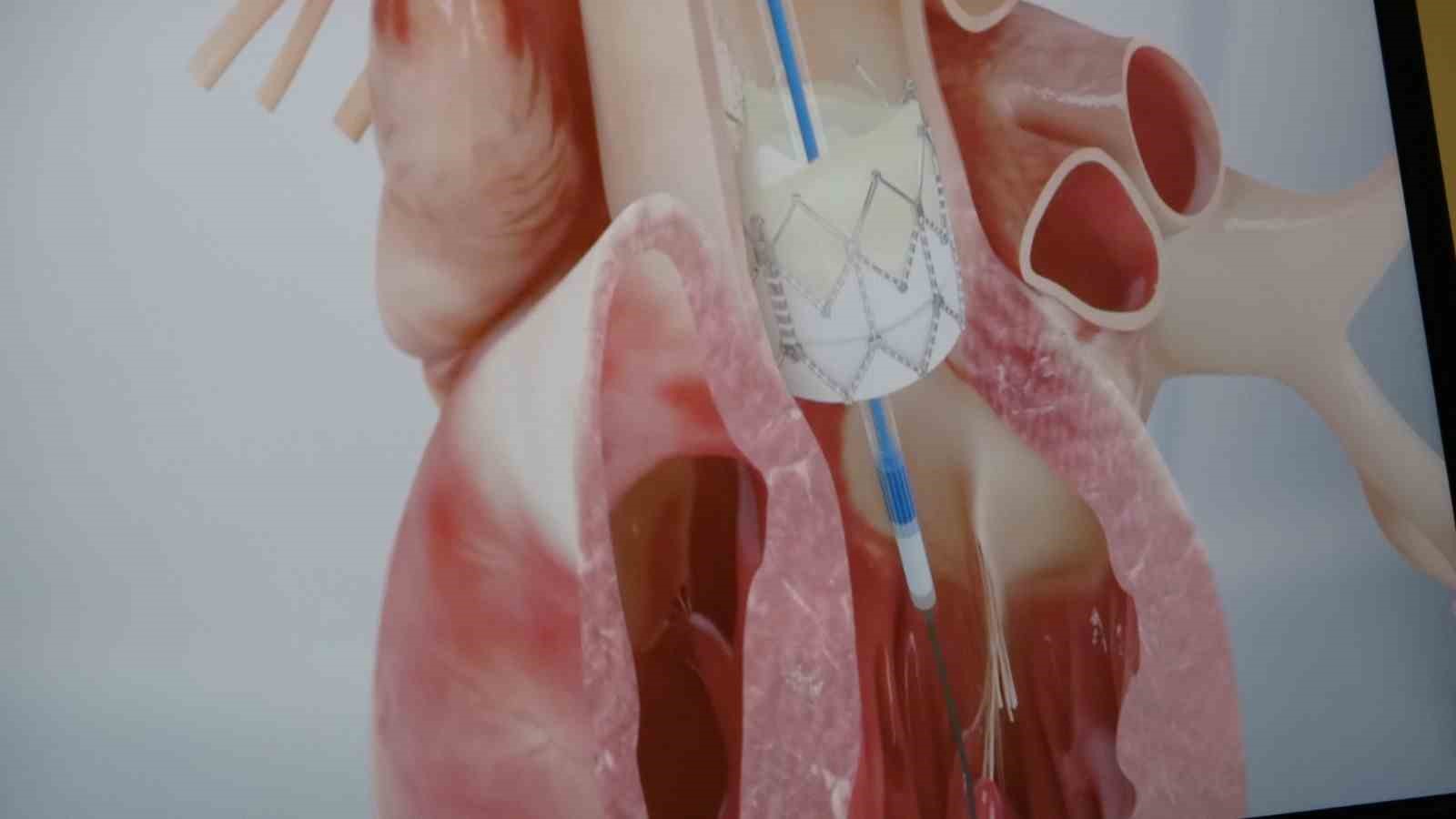 Prof. Dr. Pekdemir: “Gençlerde Ani Ölümlerin Yüzde 90’ı Genetik Nedenlerden Kaynaklanıyor”