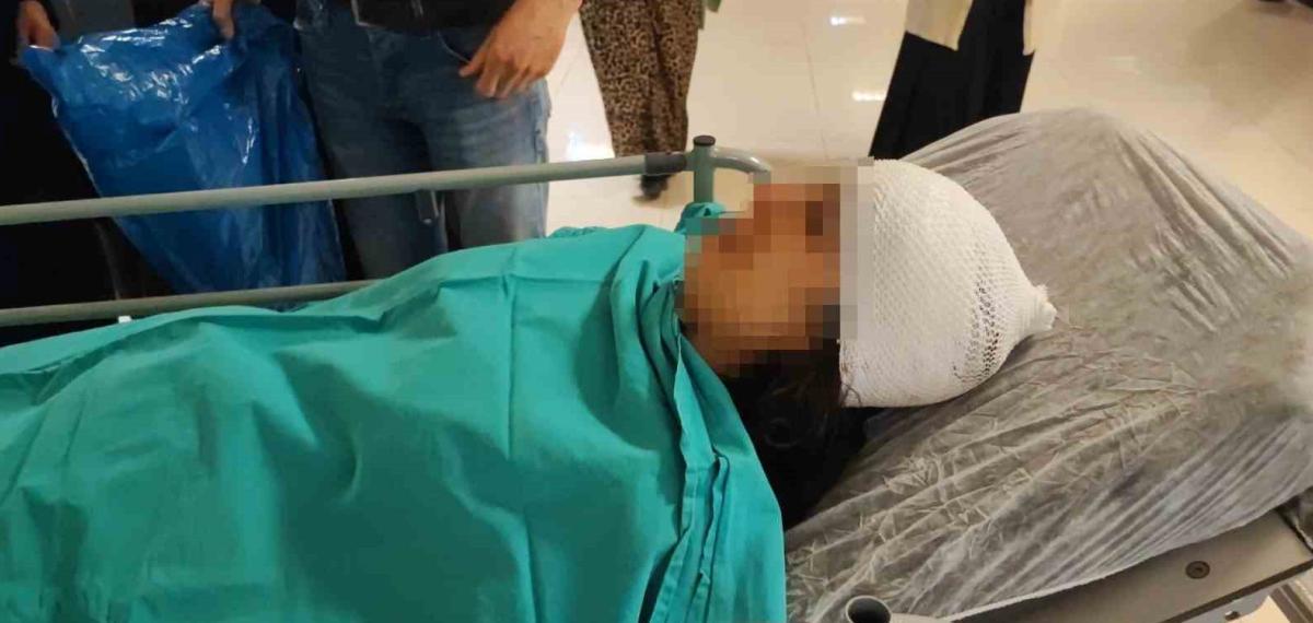 Ekmek Almaya Giderken Sokak Köpeklerinin Saldırısına Uğrayan Genç Kız Yaralandı