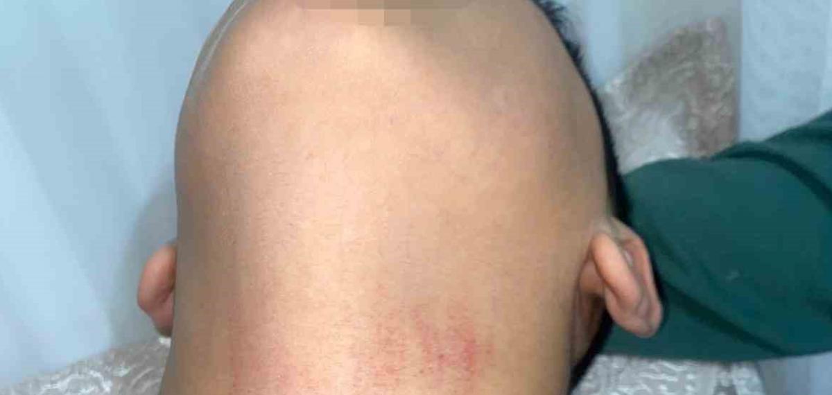 Küçükçekmece’de Kadın Memurun 10 Yaşındaki Öğrenciyi Okulda Darbettiği İddiası