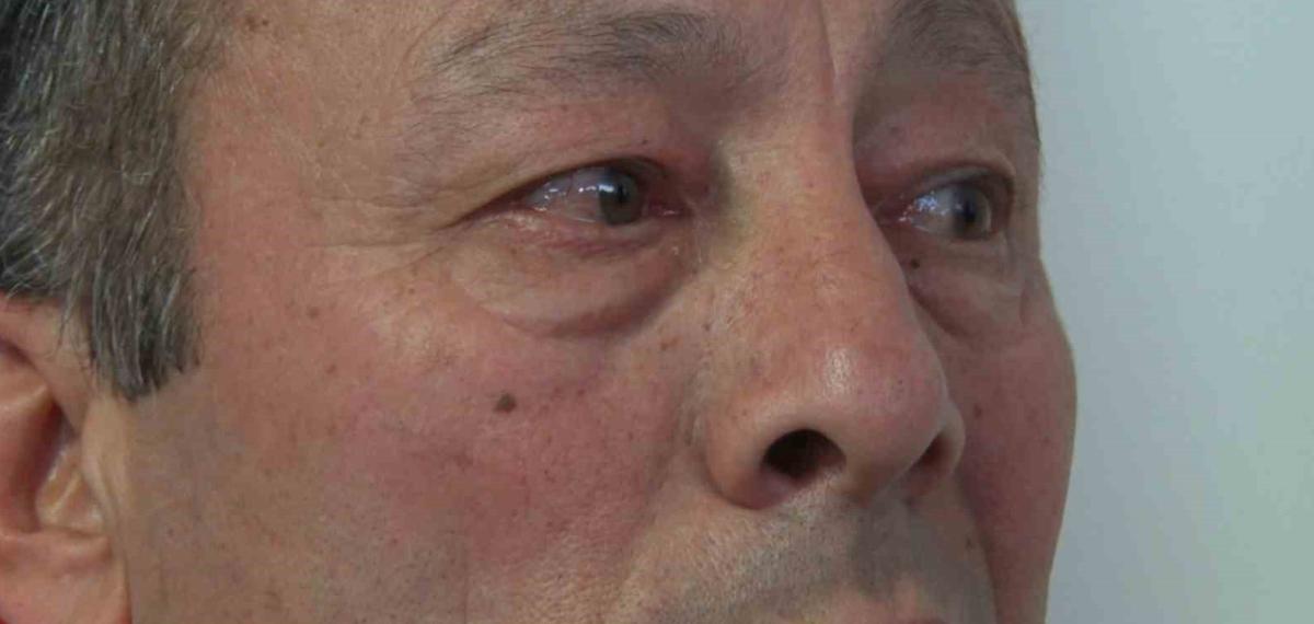 Ümraniye’deki İkinci Cinayette Acılı Baba Fenalaşarak Hastaneye Kaldırıldı