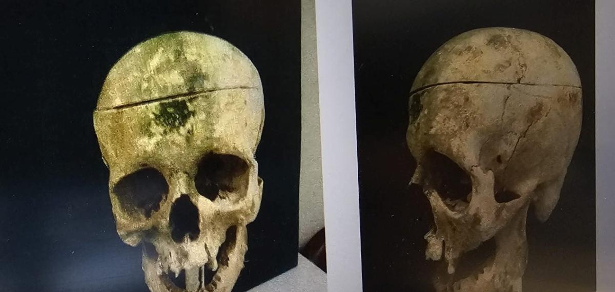 Barajdaki Kemiklerle 18 Yıllık Cinayetin Sırrı Çözüldü