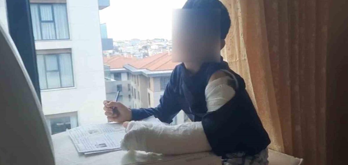 Ümraniye’de Akran Zorbalığı İddiası: Çelme Takılan Öğrencinin Kolu Kırıldı, Okul Yönetimi Ambulans Çağırmadı