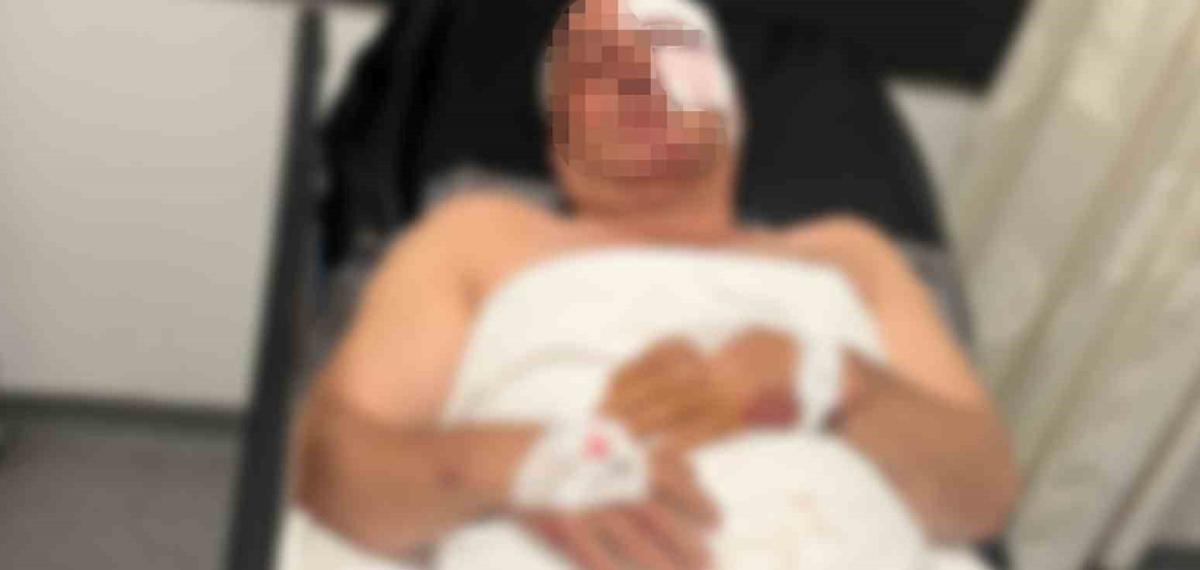 Aydın Efeler’de motosiklet kazası: 1 yaralı