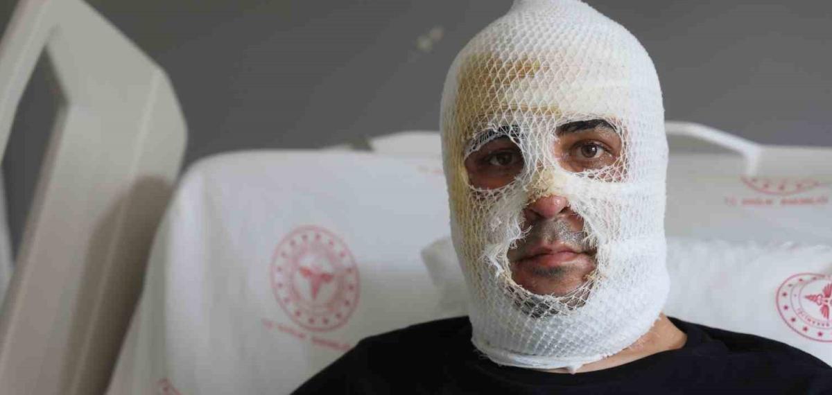 Ekmek Teknesi Küle Dönmesin Diye Çaba Eden Esnafın Yüzü ve Bedeni Yaşanan Patlamayla Yandı