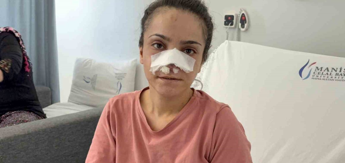 Eşinin ısırıp kopardığı burnu ameliyatla yerine dikildi, şüpheli tutuklandı