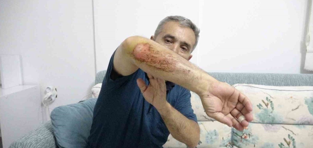 Otizmli oğluna çoban köpekleri saldırdı – Baba: Psikolojisi bozuldu