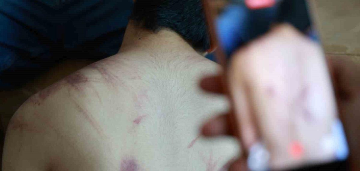 Özel eğitim merkezinde şiddet iddiası: 14 yaşındaki engelli çocuk darp raporu aldı