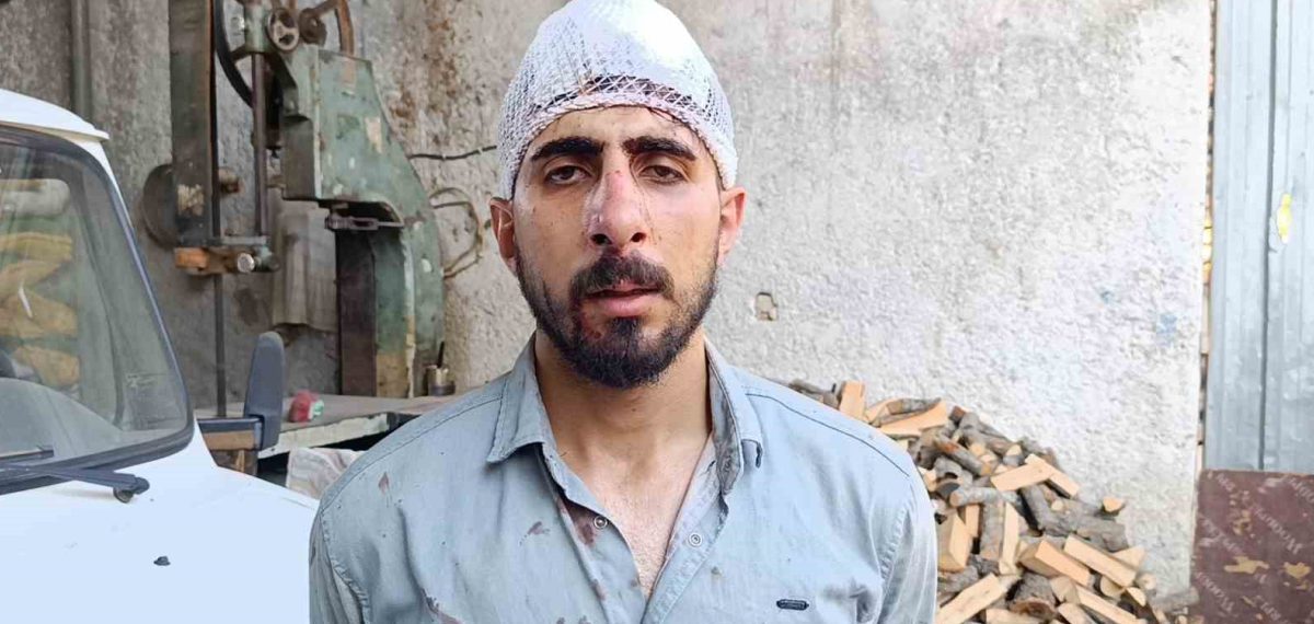 Eyyübiye’de önünü kesip 3 kişinin darbettiği sürücü burnu kırılarak hastanelik oldu