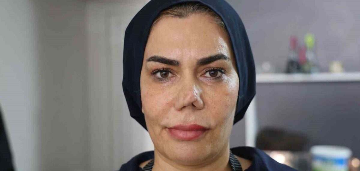İş yerinde darp sonucu kırılan burnu için gittiği cerrahtan şikayetçi oldu