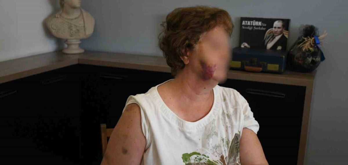 Kuşadası’nda mülkiyet tartışması kanlı bitti: Anne ve iki çocuğu bıçaklandı