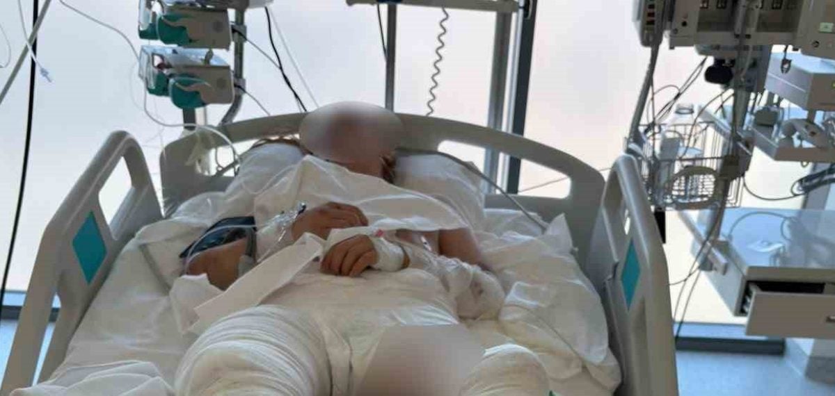 Otomobilin çarptığı genç kız ağır yaralandı, sürücü teslim oldu