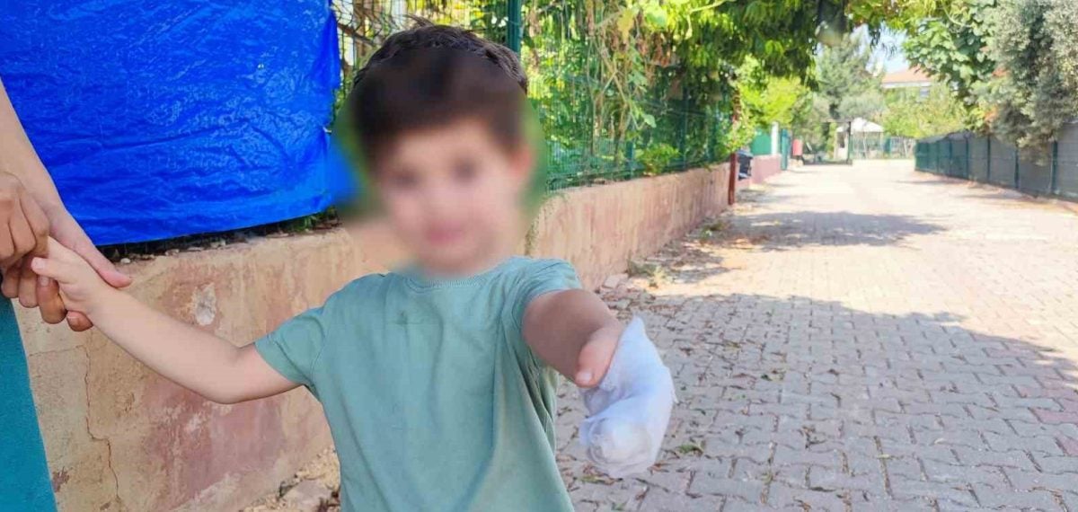 Parke taşına sıkışan 3 yaşındaki çocuğa polis eskortu ile hastaneye yetiştirildi