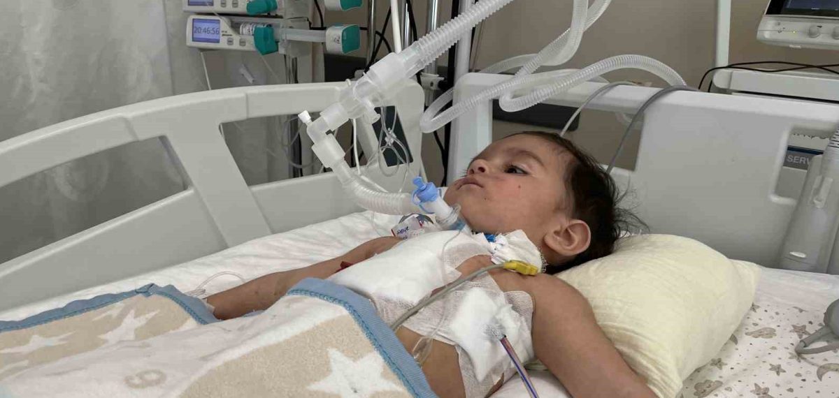 1 yaşındaki bebeğin akciğerinden ECMO desteğiyle çıkarılan ceviz şaşırttı