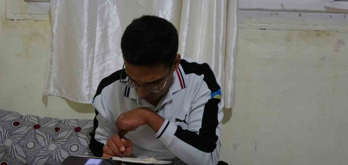 Kilis’te iş kazasında beş parmağını kaybeden işçiye 500 bin lira teklif edildi